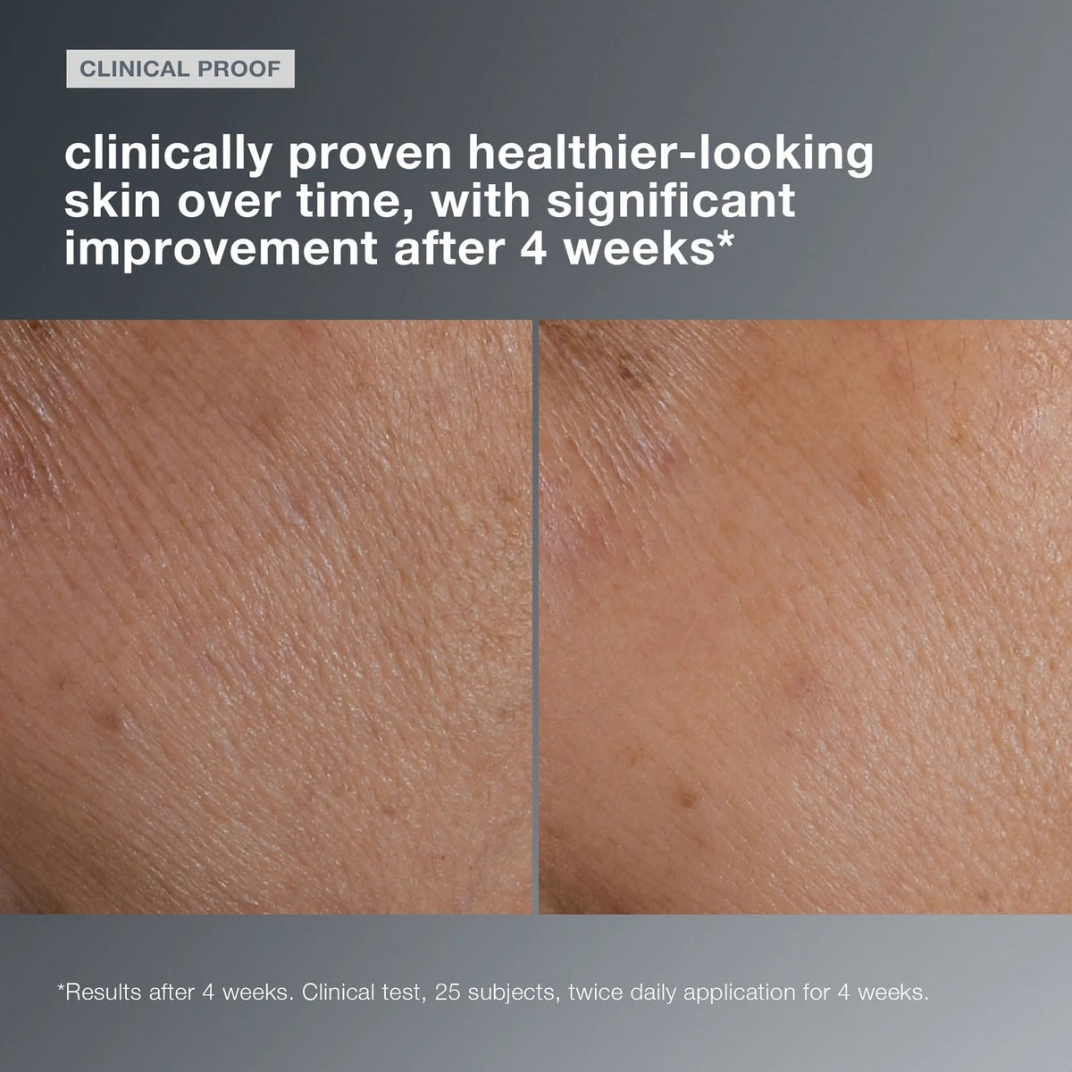 DERMALOGICA Smart Response Serum 30ml