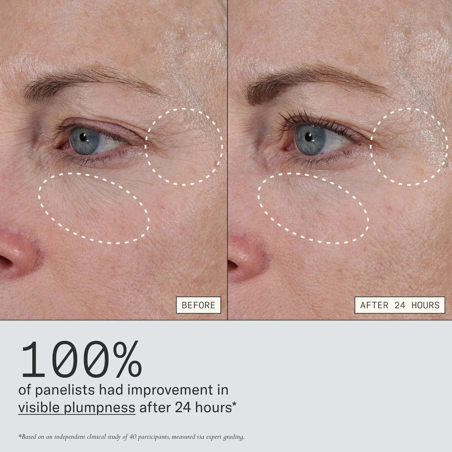 Dieux Instant Angel Lipid-Rich Firming Moisturizer