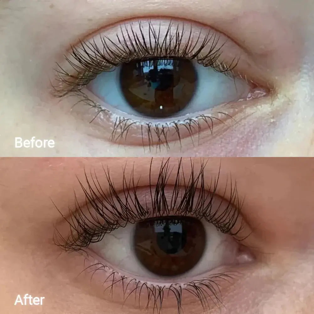 ForChics Eyelash Serum Twin Pack × 1