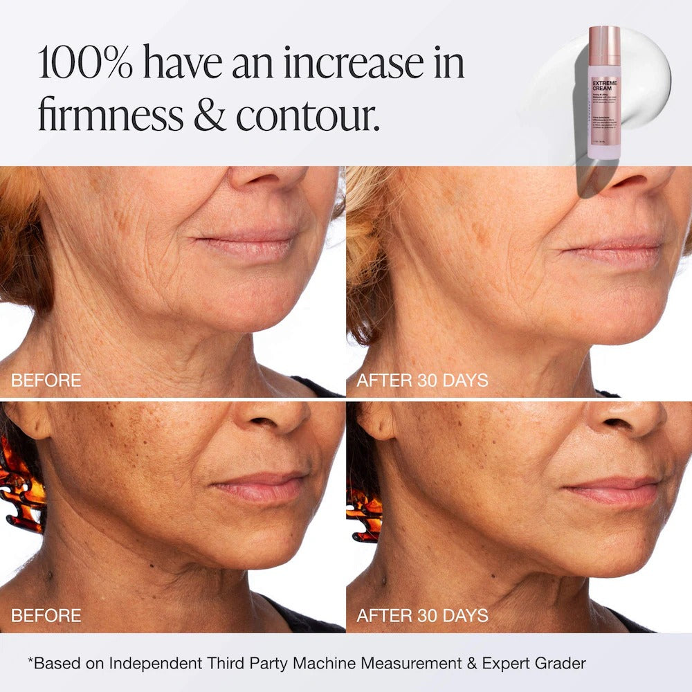 Innbeauty Project Extreme Cream Anti-Aging, Firming, & Lifting Refillable Moisturizer