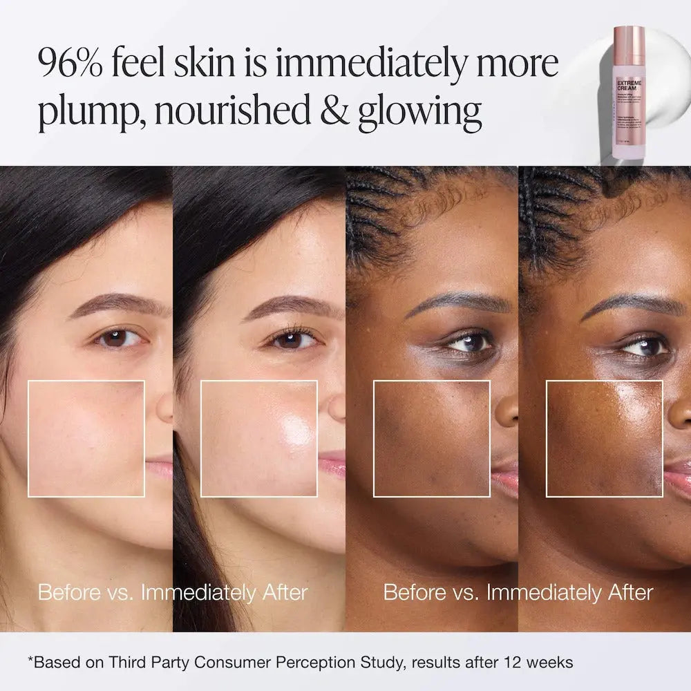 Innbeauty Project Extreme Cream Anti-Aging, Firming, & Lifting Refillable Moisturizer