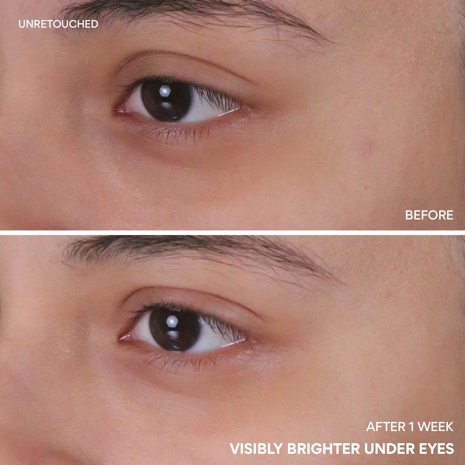 Innisfree Vitamin C Niacinamide Brightening Eye Serum for Dark Circles 10ml
