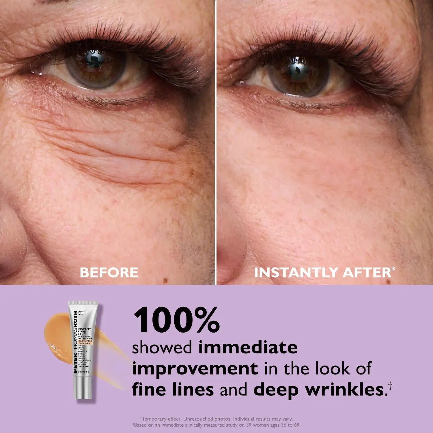 Peter Thomas Roth Instant FIRMx® Eye Temporary Eye Tightener