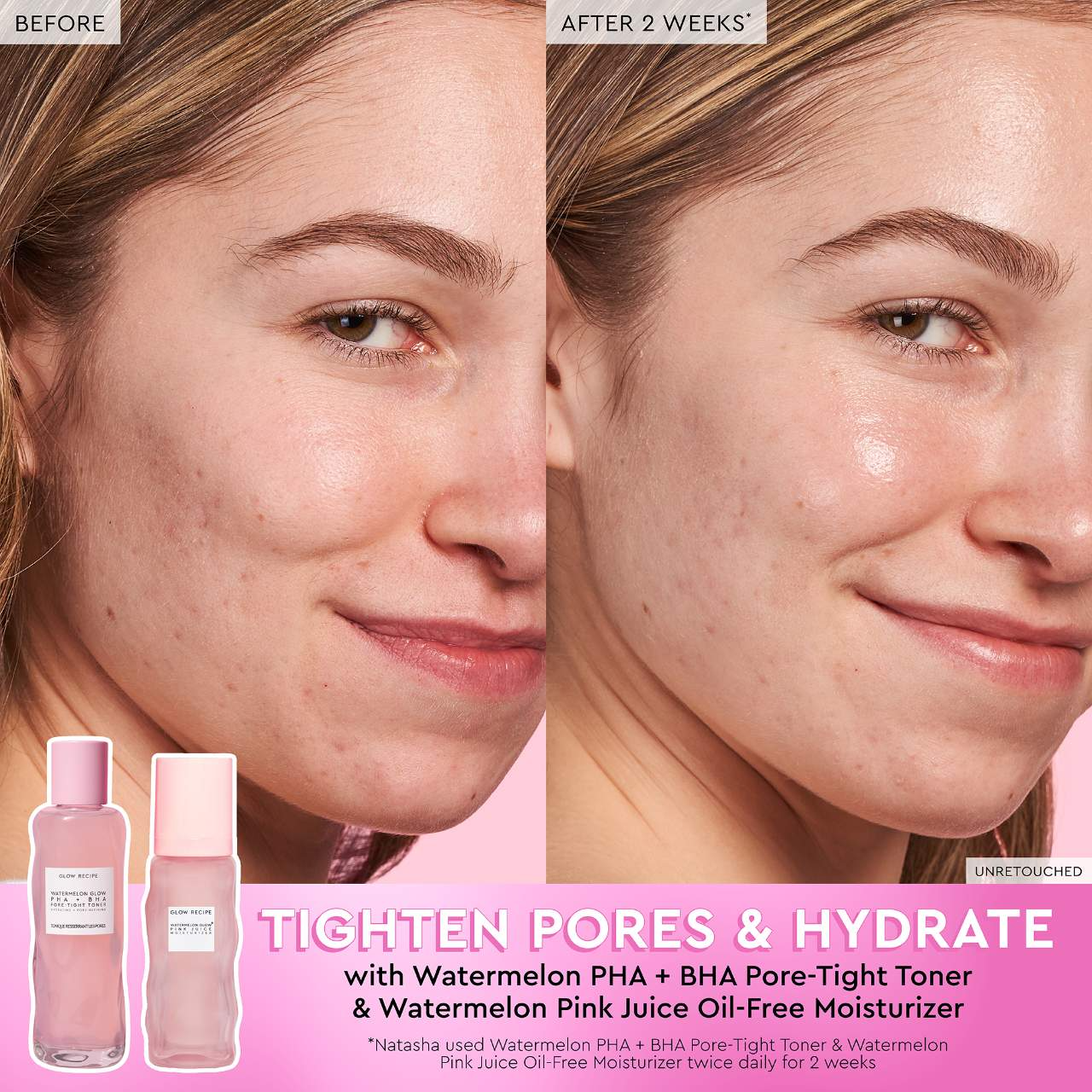 Glow Recipe Watermelon Glow PHA + BHA Pore-Tight Toner (150ml)
