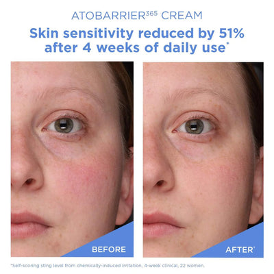 AESTURA ATOBARRIER365 Cream Moisturizer 80ml    