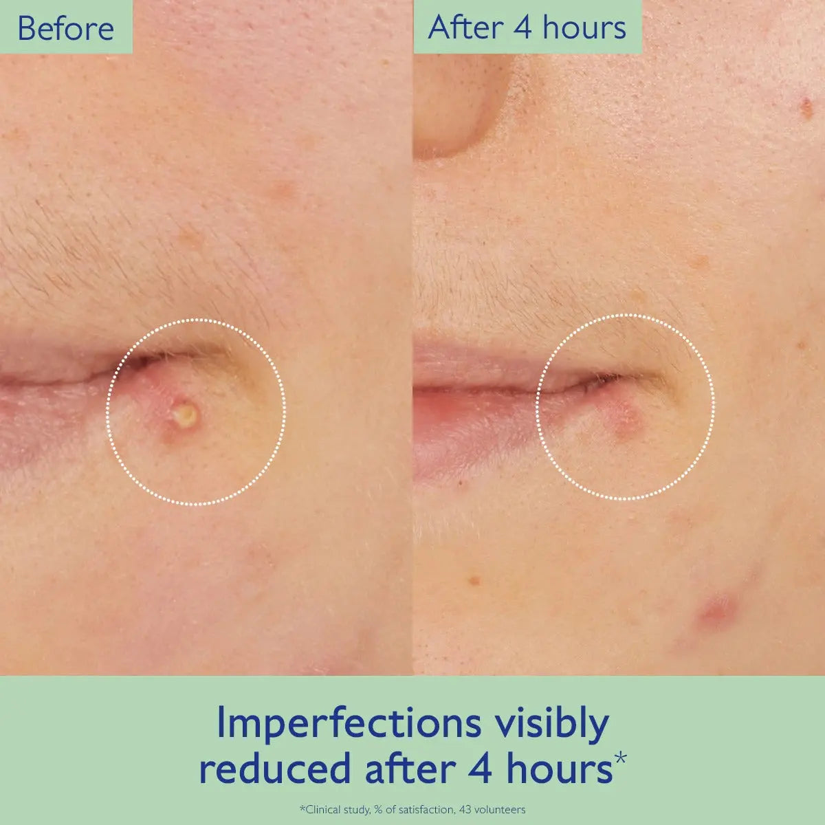 Caudalie Vinopure Targeted Spot Solution with Salicylic Acid    