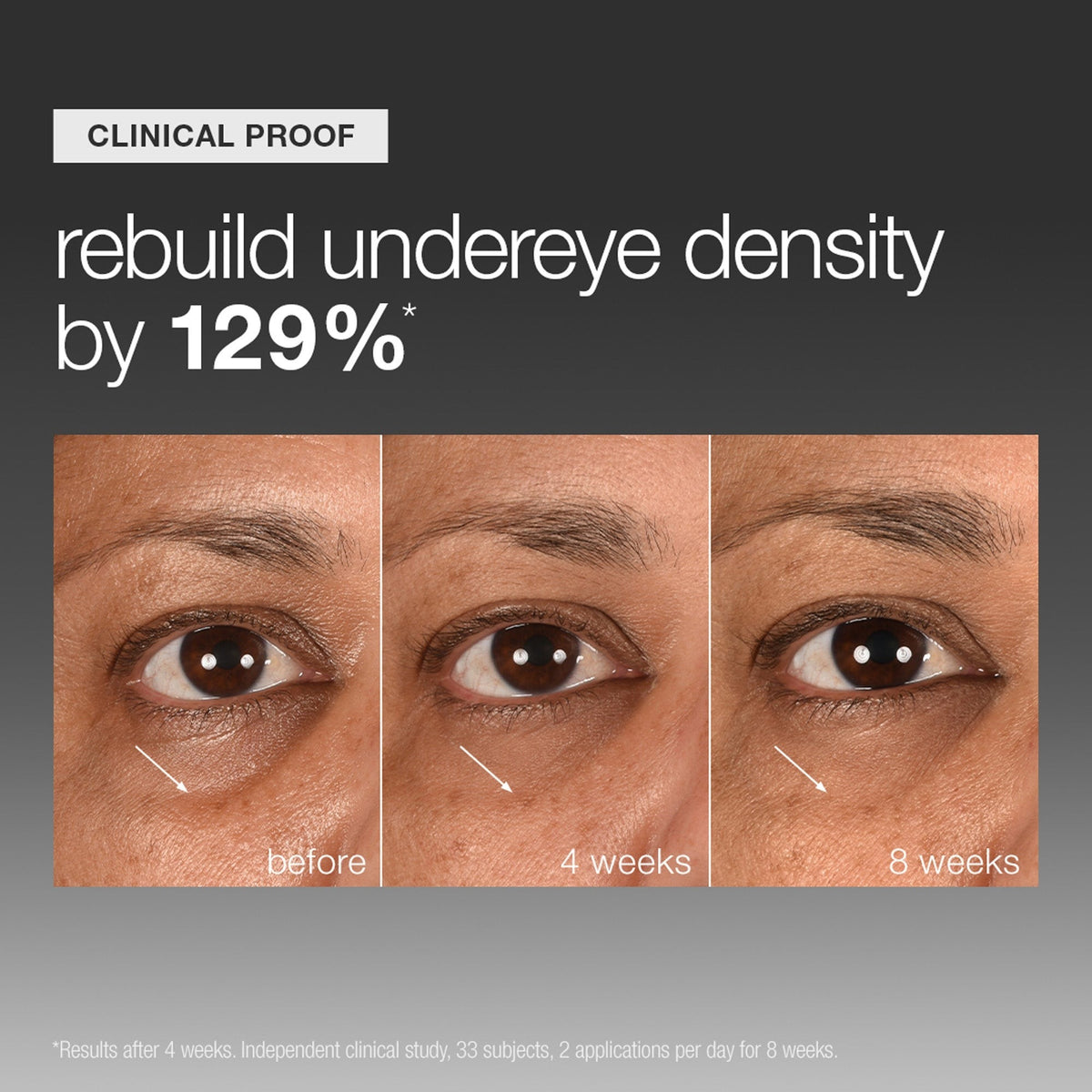 Dermalogica Smart Eye Density Serum 15ml    