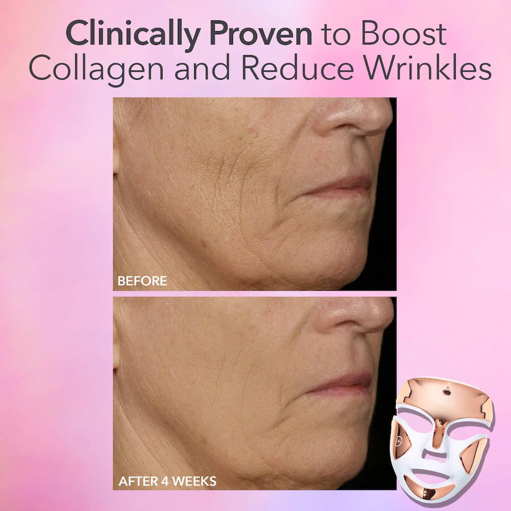 Dr. Dennis Gross Skincare  DRx SpectraLite™ FaceWare Pro 3-Minute LED Device    