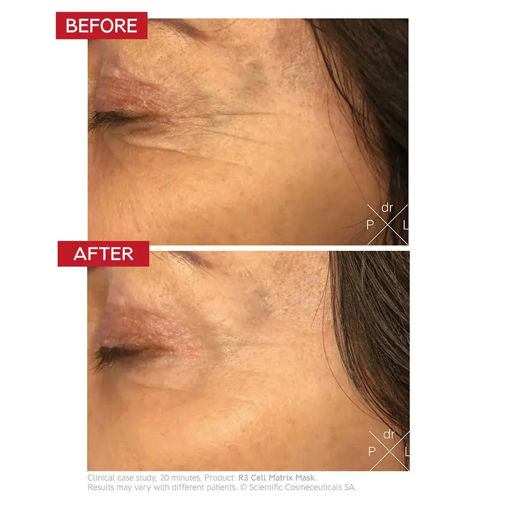 Dr.Levy R3 Cell Matrix Mask    
