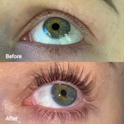 ForChics Eyelash Serum Twin Pack × 1    