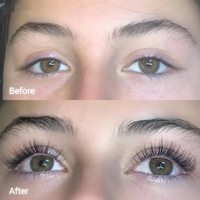 ForChics Eyelash Serum Twin Pack × 1    