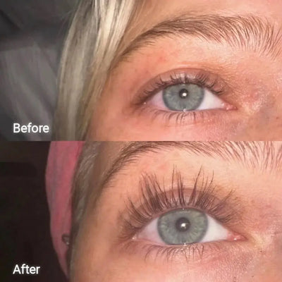 ForChics Eyelash Serum Twin Pack × 1    
