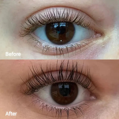 ForChics Eyelash Serum Twin Pack × 1    
