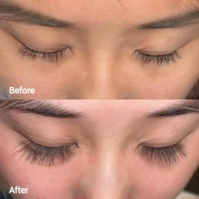 ForChics Eyelash Serum Twin Pack × 1    