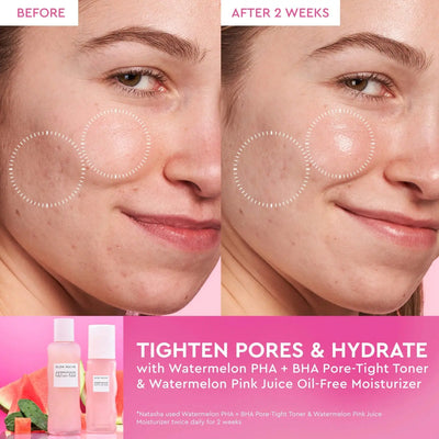Glow Recipe  Watermelon Glow Dewy Skin Routine Gift Set    