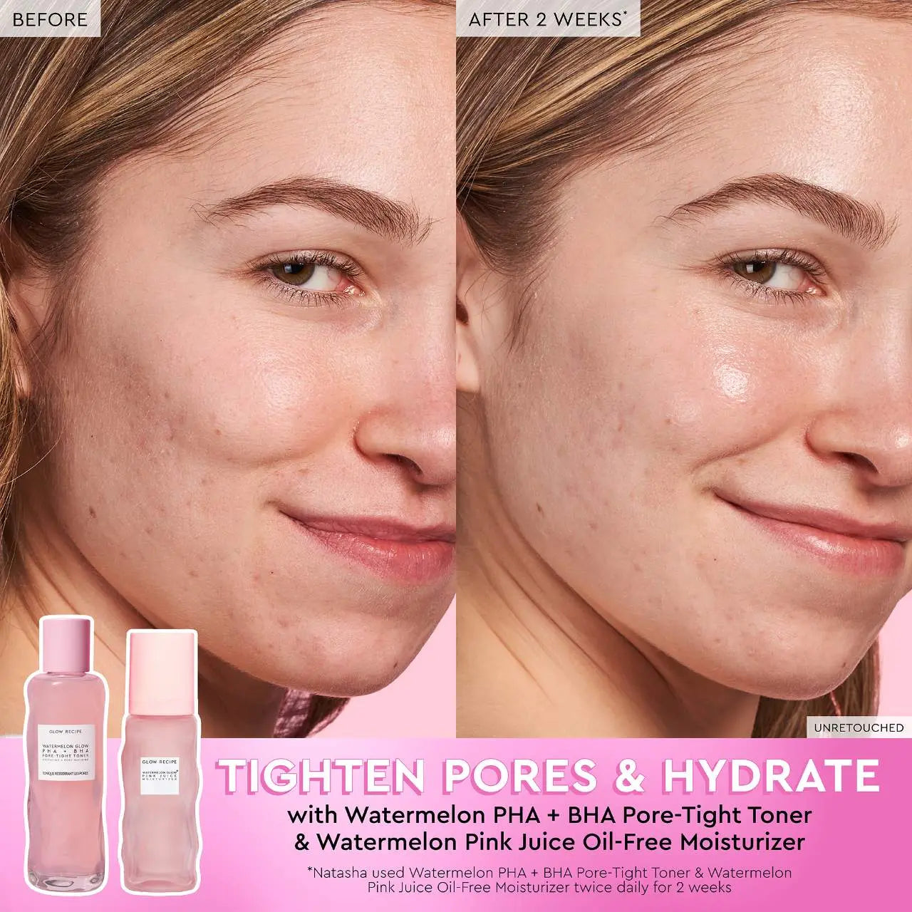Glow Recipe  Watermelon Glow PHA + BHA Pore-Tight Toner (150ml)    