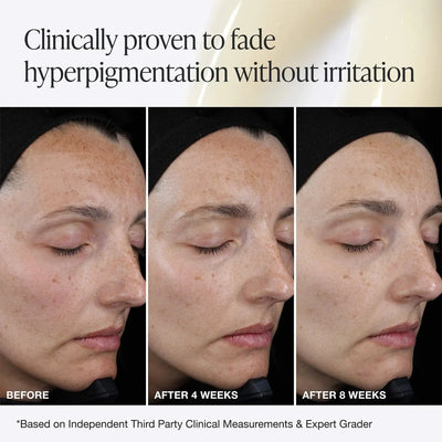 INNBEAUTY PROJECT Pro C Serum Brightening Solution with 15% Vitamin C + Ferulic Acid    