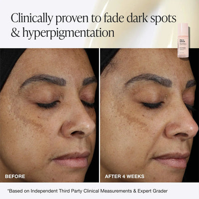 INNBEAUTY PROJECT Pro C Serum Brightening Solution with 15% Vitamin C + Ferulic Acid    