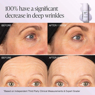 INNBEAUTY PROJECT Elastic Skin Firming & Plumping Vegan Growth Factor Serum 28g    