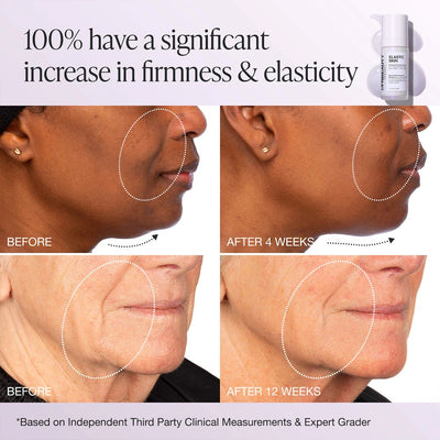 INNBEAUTY PROJECT Elastic Skin Firming & Plumping Vegan Growth Factor Serum 28g    