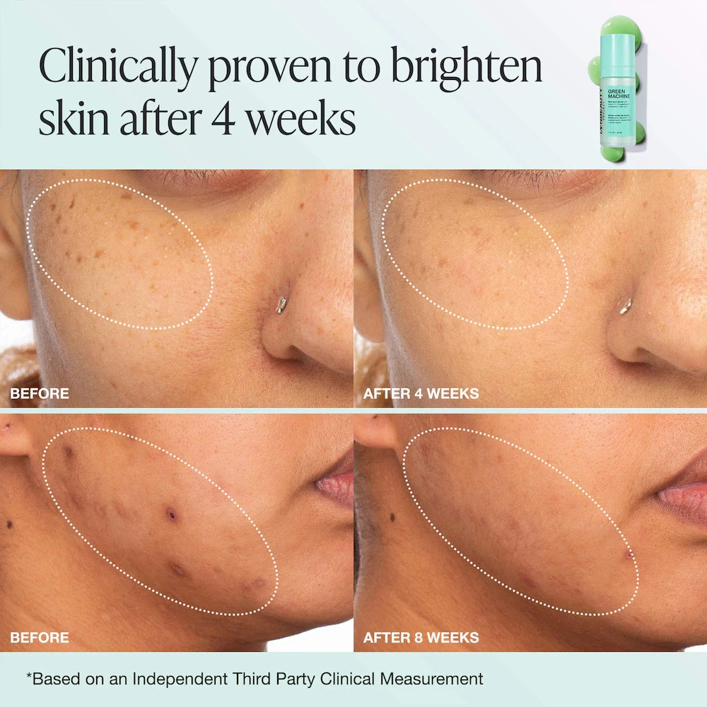 INNBEAUTY PROJECT  Green Machine Vitamin C Dark Spot & Hyperpigmentation Serum 30ml    