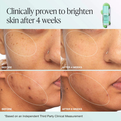 INNBEAUTY PROJECT  Green Machine Vitamin C Dark Spot & Hyperpigmentation Serum 30ml    