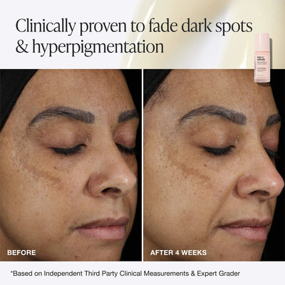 INNBEAUTY PROJECT Pro C Serum Brightening Solution with 15% Vitamin C + Ferulic Acid    