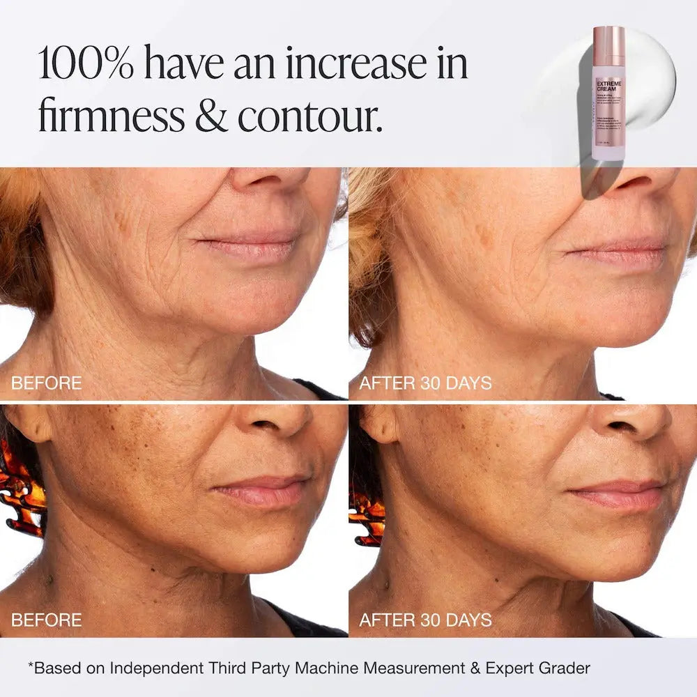 Innbeauty Project Extreme Cream Anti-Aging, Firming, & Lifting Refillable Moisturizer    