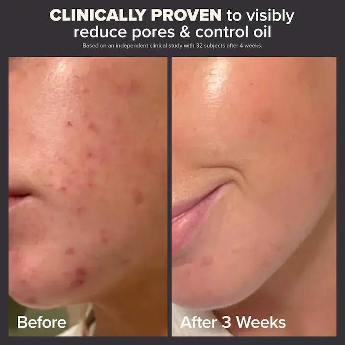 Paula's Choice Mini Skin Perfecting 2% BHA Liquid Exfoliant for Clear Skin    