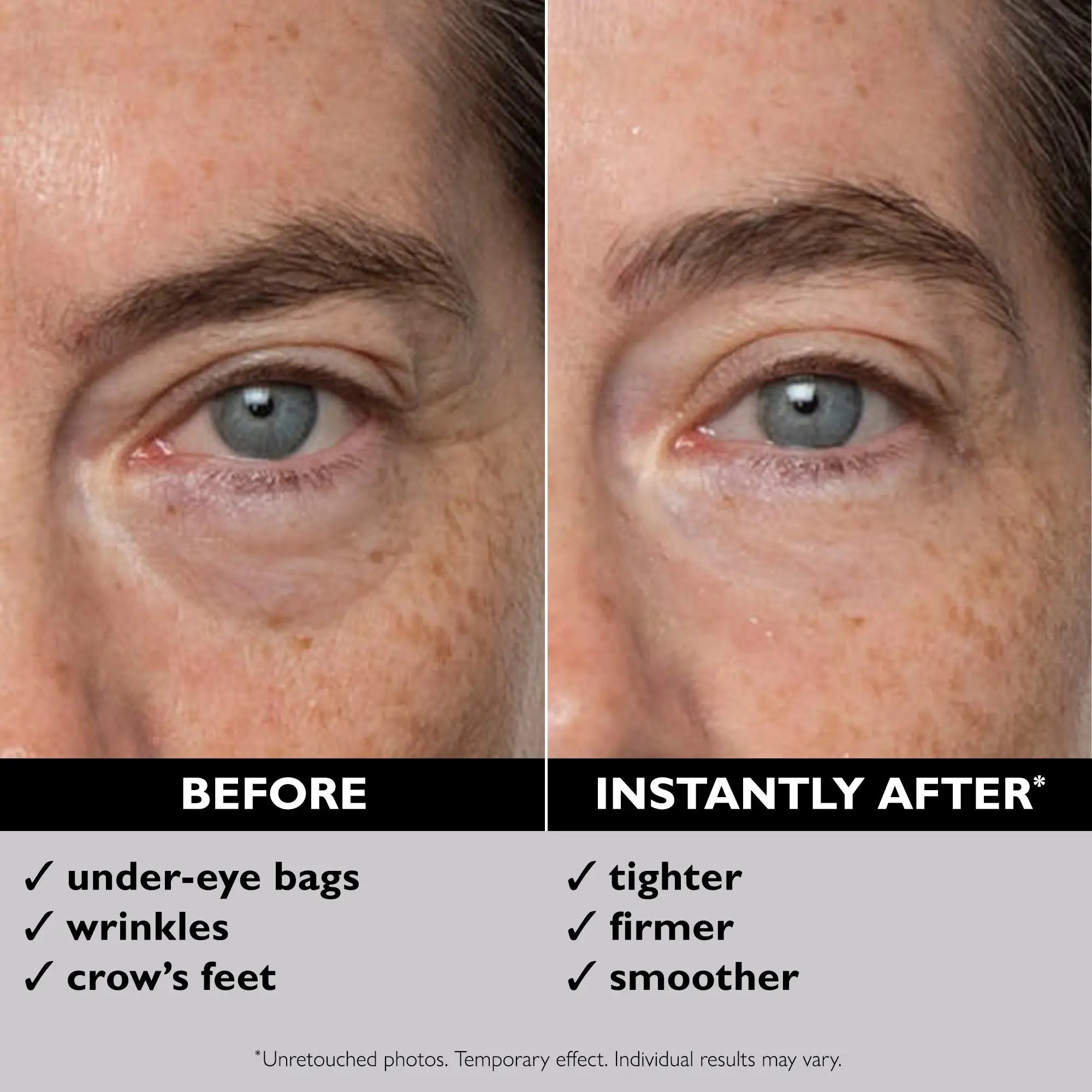 Peter Thomas Roth Instant FIRMx Eye Temporary Eye Tightener 15ml    