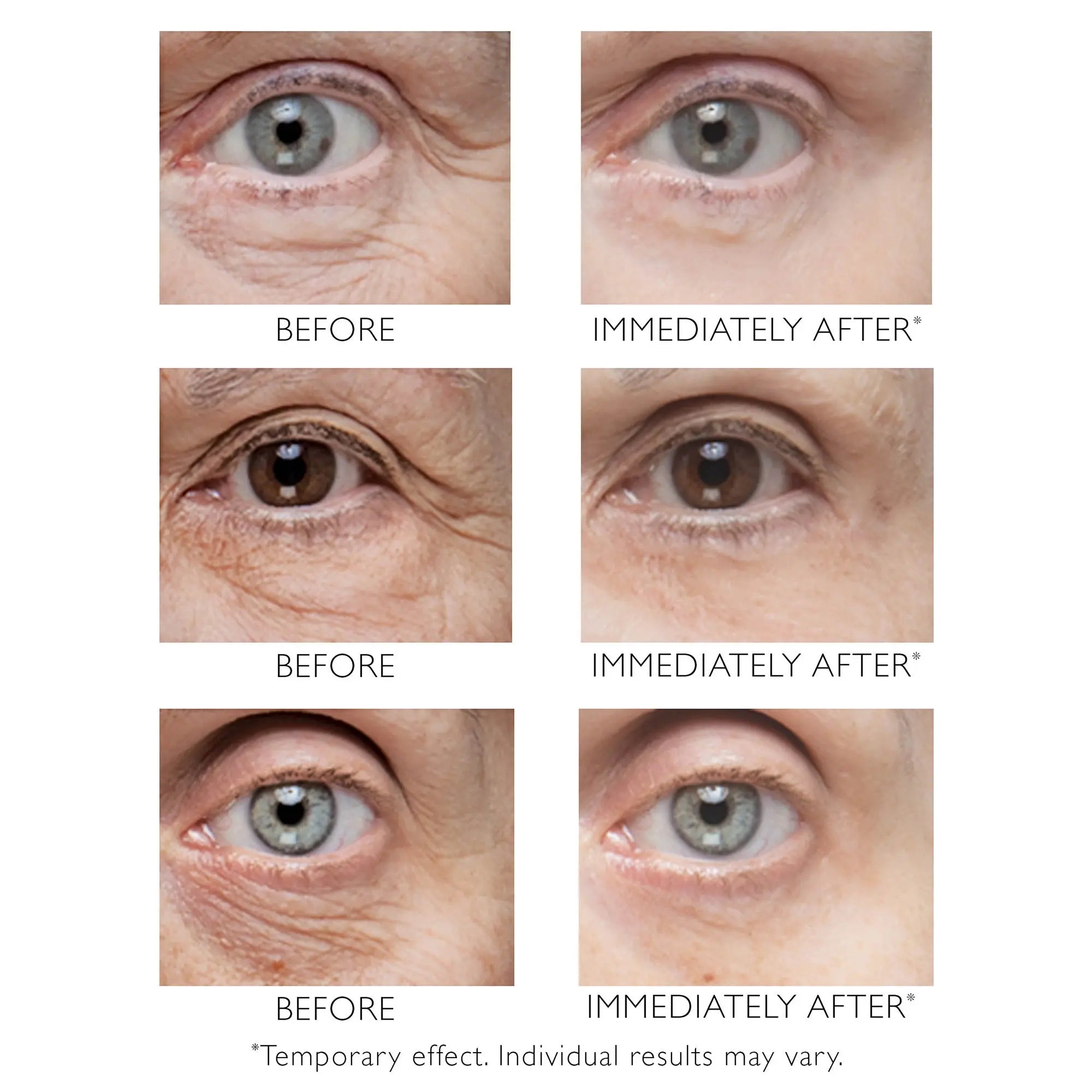 Peter Thomas Roth Instant FIRMx Eye Temporary Eye Tightener 15ml    