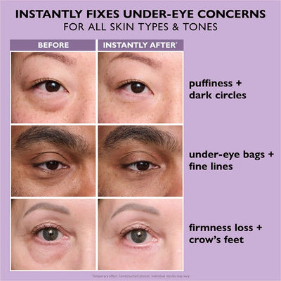 Peter Thomas Roth Instant FIRMx Temporary Eye Tightener Easy-Wear Formula 20ml    