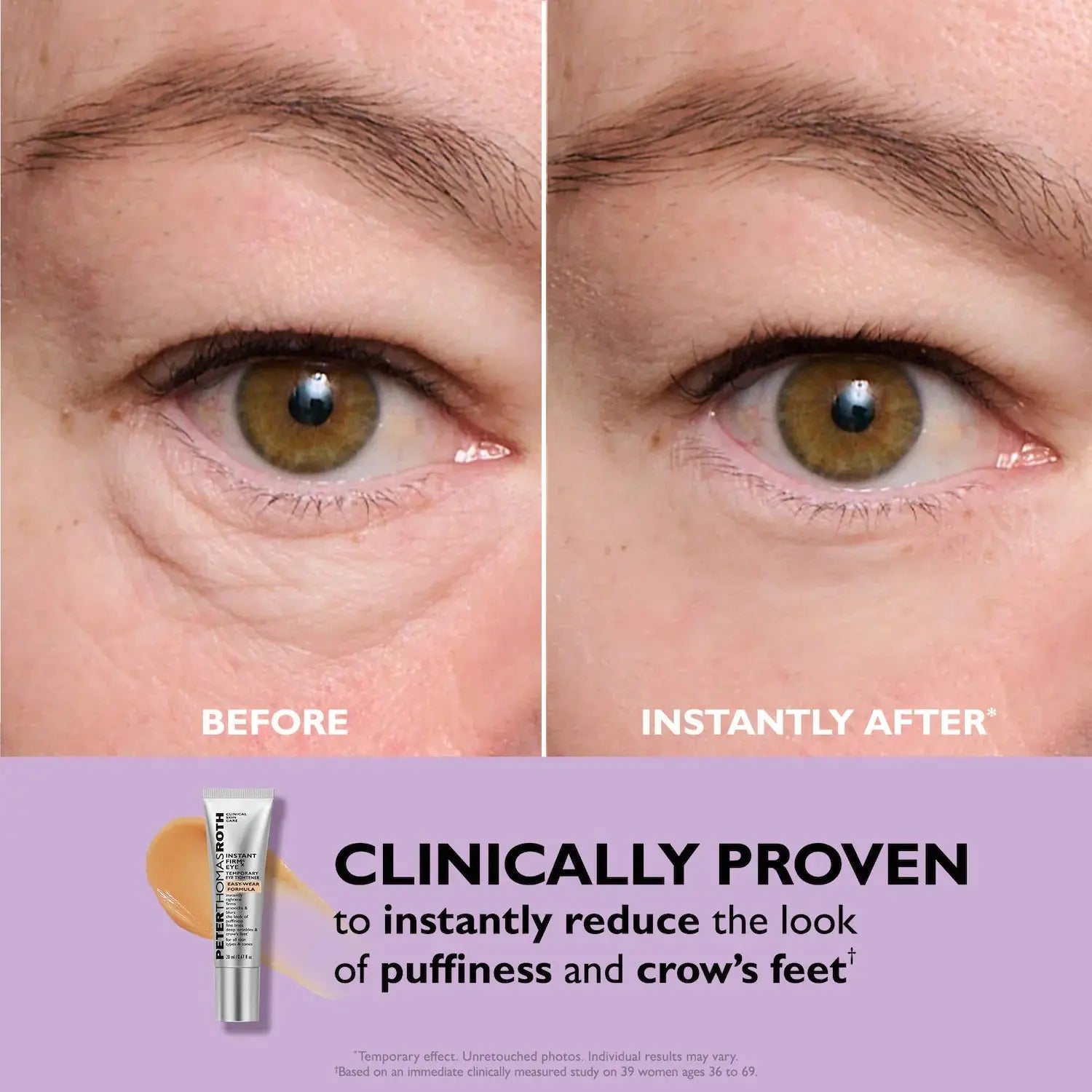 Peter Thomas Roth Instant FIRMx® Eye Temporary Eye Tightener    