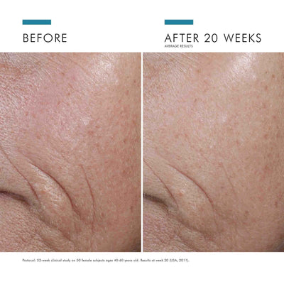 SkinCeuticals P-TIOX    