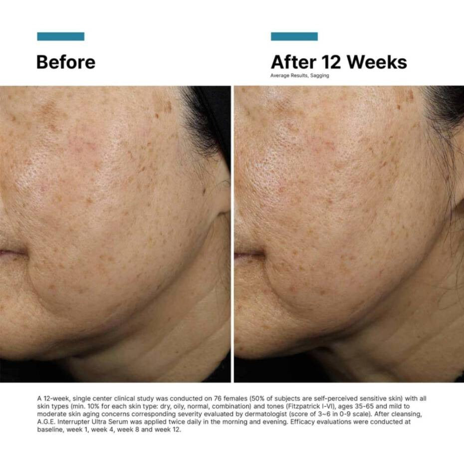 SkinCeuticals A.G.E. Interrupter Ultra Serum 30ml    