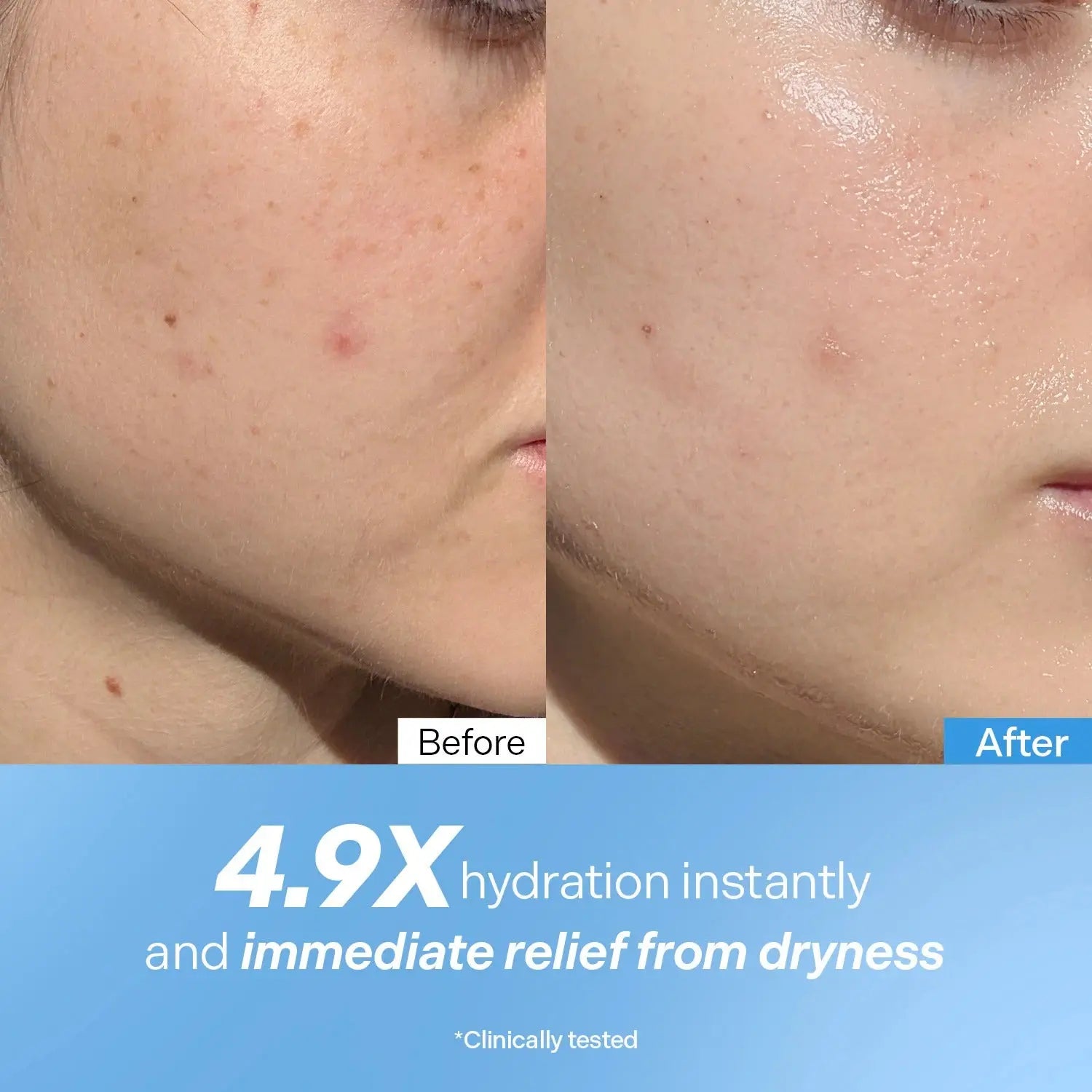 Torriden DIVE IN 5D Hyaluronic Acid Intensive Cream for dry Skin & Moisture Barrier Support    