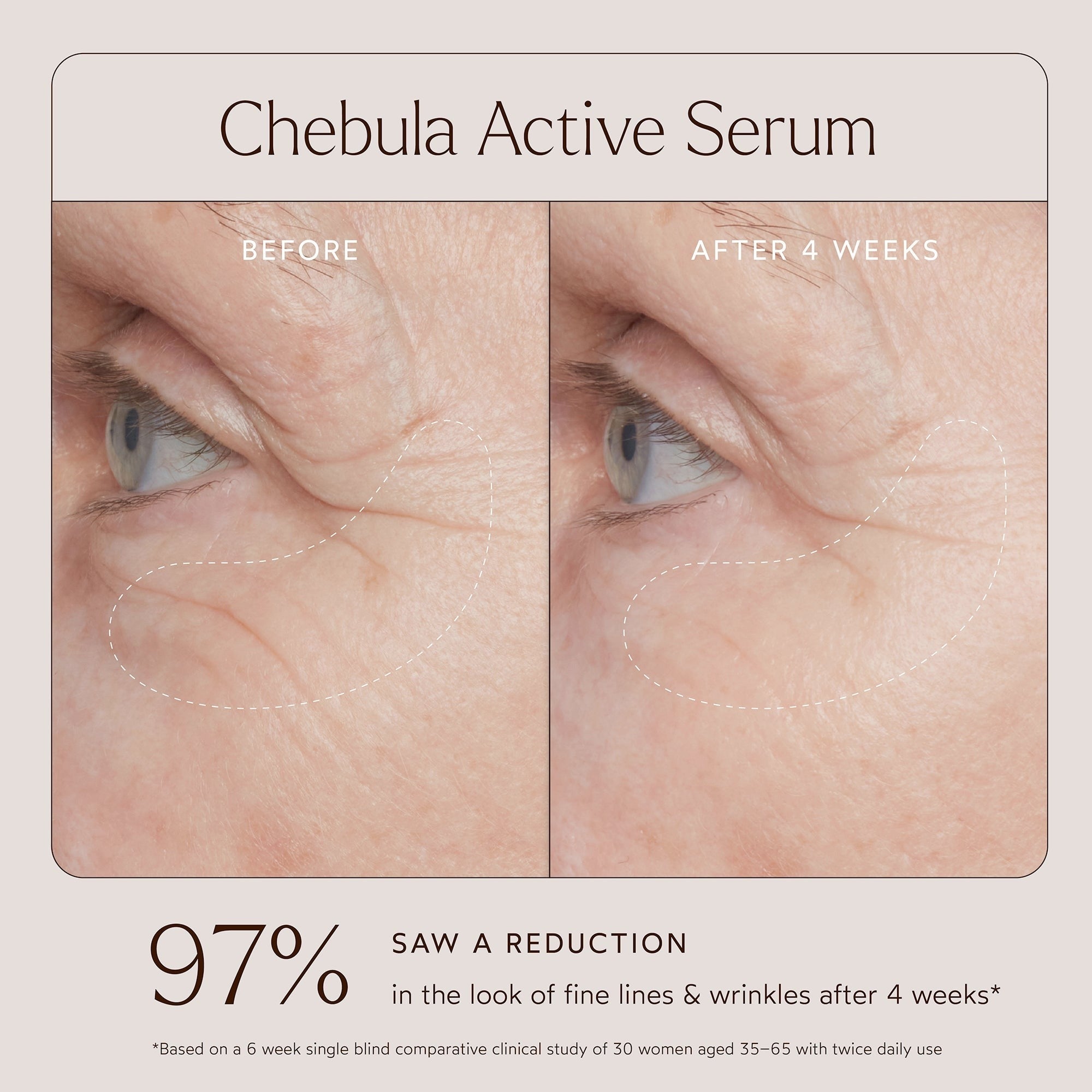 True Botanicals Chebula Active Anti-Aging Serum 30ml    