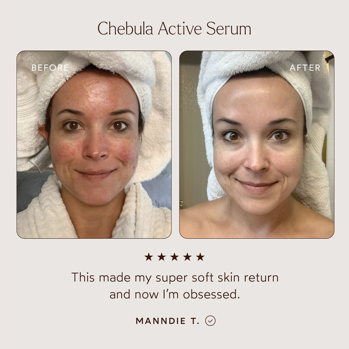 True Botanicals Chebula Active Anti-Aging Serum 30ml    