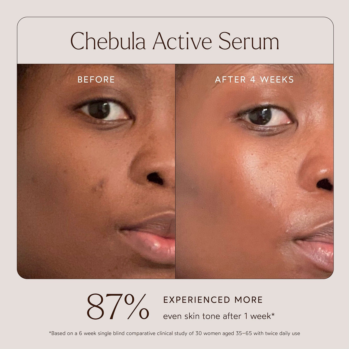 True Botanicals Chebula Active Anti-Aging Serum 30ml    