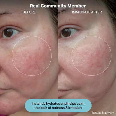 cocokind Hydrating Electrolyte Rescue Serum    