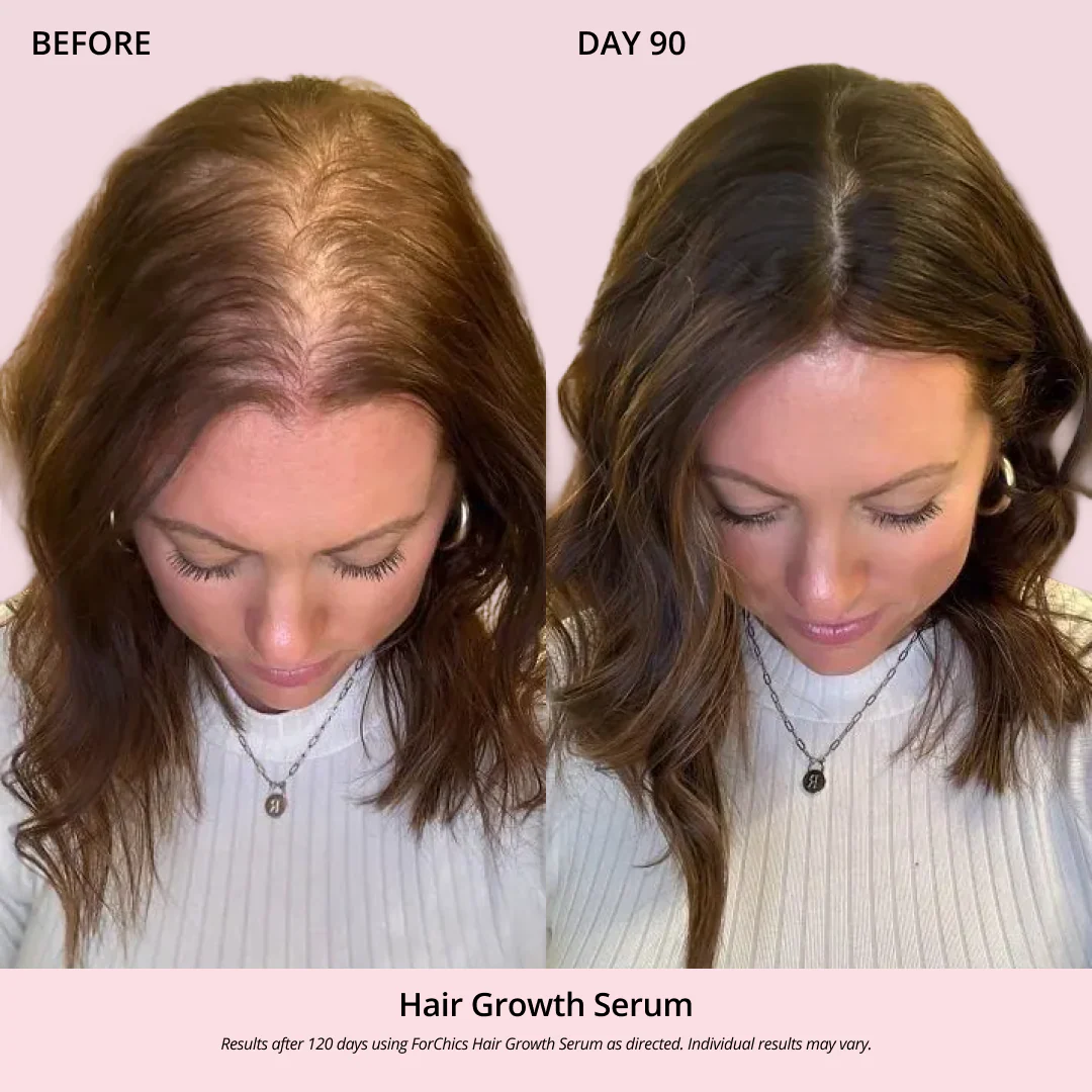 ForChics Hair Growth Oil Spray    
